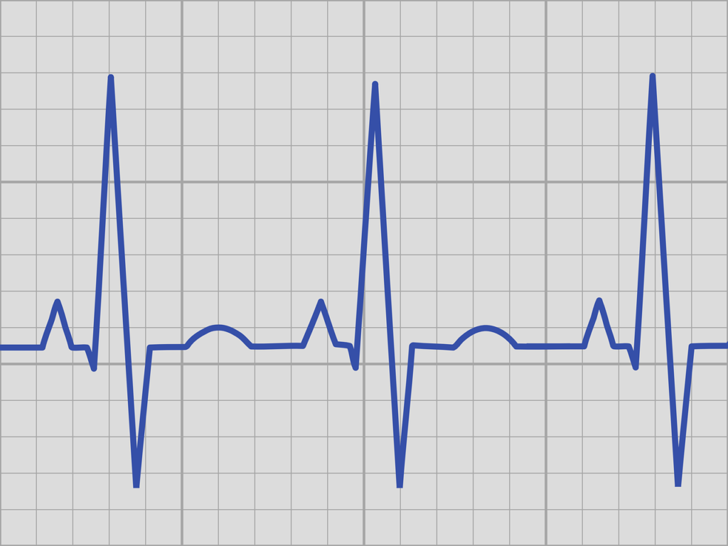 ecg, echo kardiogram, rhythm-3345115.jpg